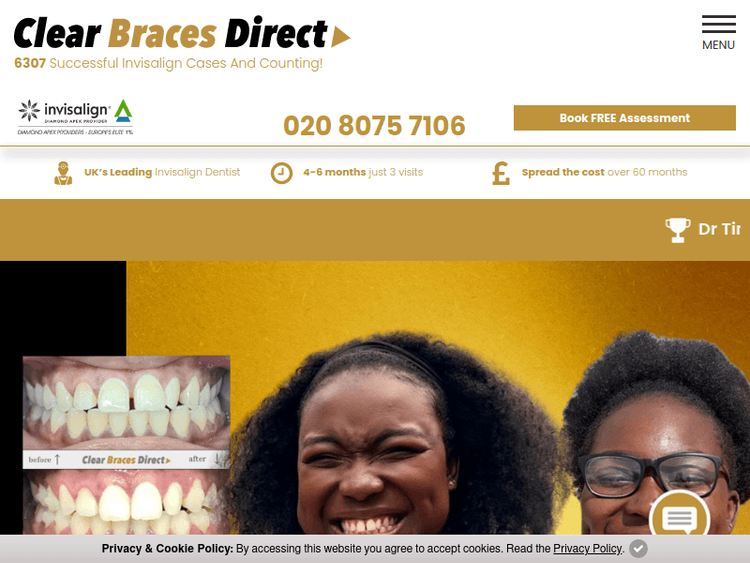 Clearbraces-direct