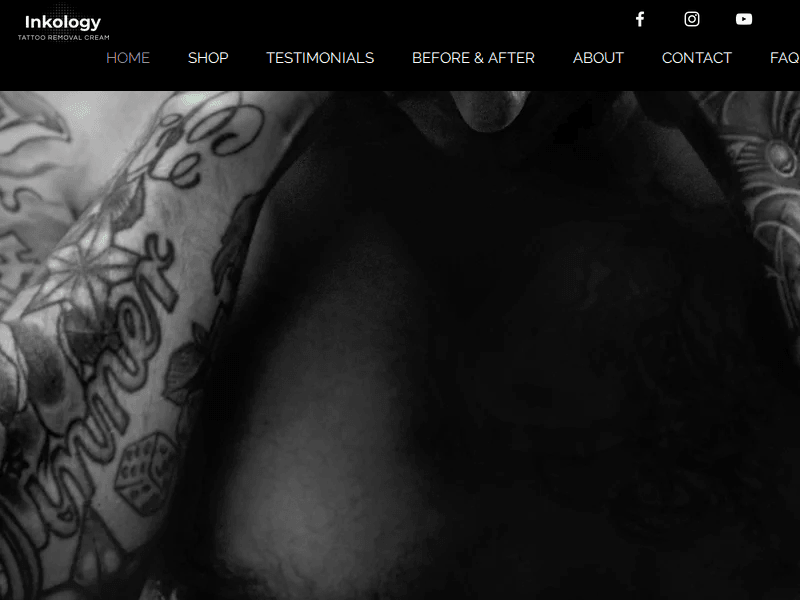 Tattooremovalcream