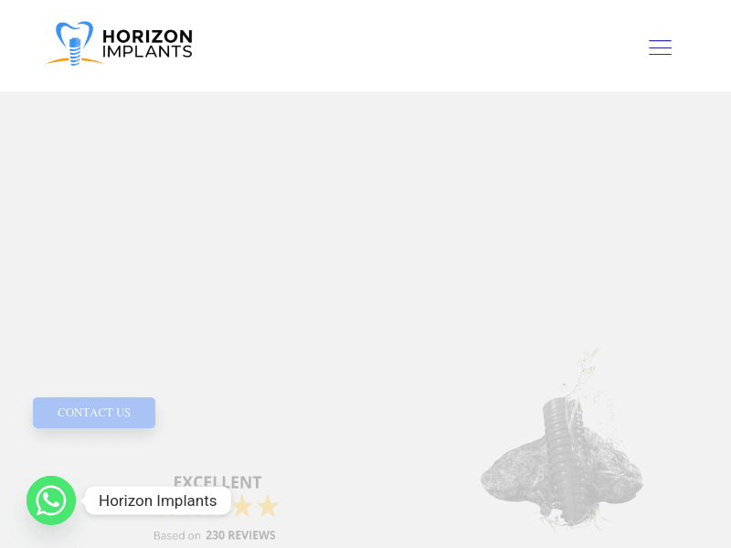 Horizonimplants