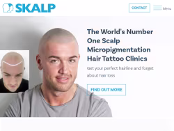 Skalp