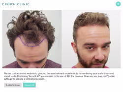Crownclinic