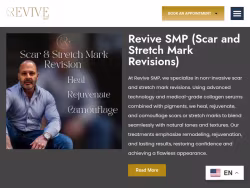 Smprevive